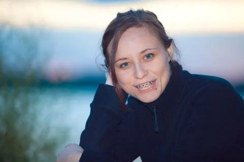 Teeth with braces 库存照片