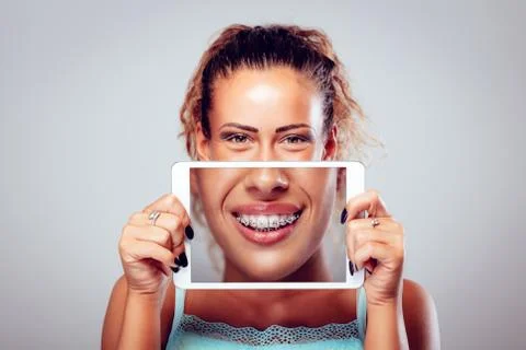 Teeth With Braces Stock Photos