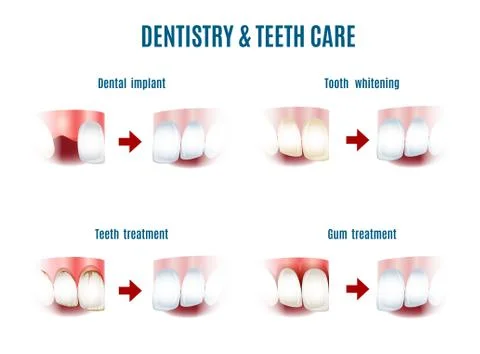 Teeth Care Stock Illustration