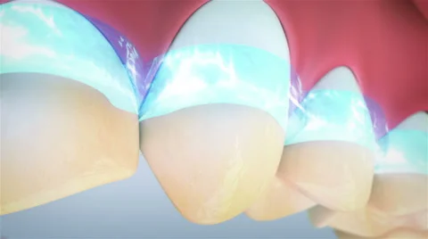 Teeth cleaning 库存影片 38491954