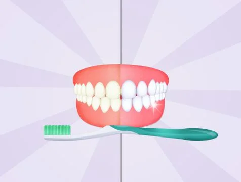 Teeth cleaning Stock Illustration