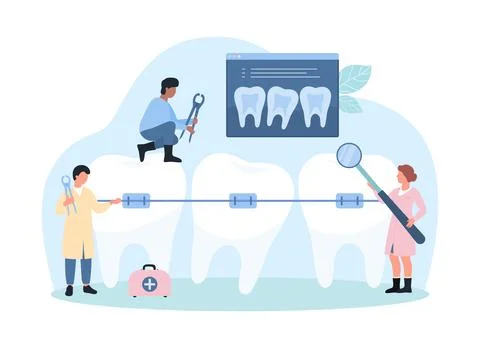 Teeth correction with metal braces on wire, orthodontics and stomatology by tiny Stock Illustration