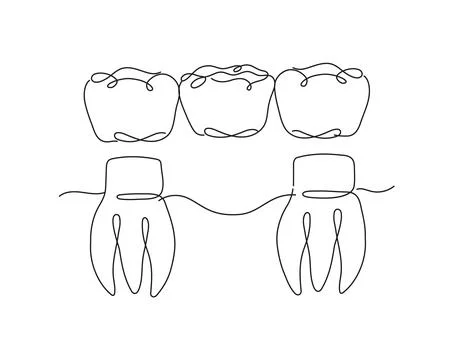 Teeth with crown bridge flat line white color Stock Illustration