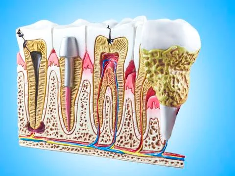 Teeth, dental section model. Stock Illustration