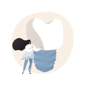 Teeth dentures implants abstract concept vector illustration. 스톡 일러스트