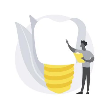 Teeth dentures implants abstract concept vector illustration. 스톡 일러스트