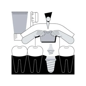 Teeth dentures implants abstract concept vector illustration. 스톡 일러스트