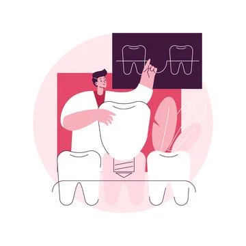 Teeth dentures implants abstract concept vector illustration. Stock Illustration