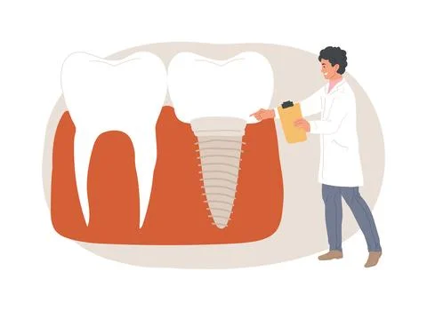 Teeth dentures implants isolated concept vector illustration. 스톡 일러스트