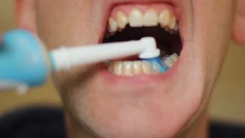 Teeth Stock Footage 88437451