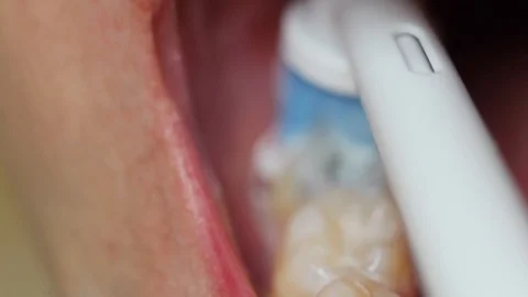 Teeth Stock Footage 88438705