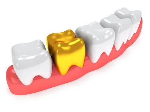 Teeth on gingiva isolated on white back. 스톡 일러스트