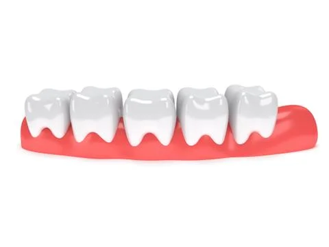 Teeth on gingiva isolated on white back. 스톡 일러스트