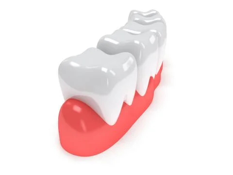 Teeth on gingiva isolated on white back. 스톡 일러스트