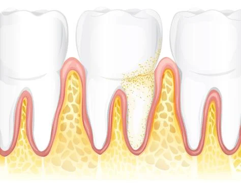 Teeth Stock Illustration