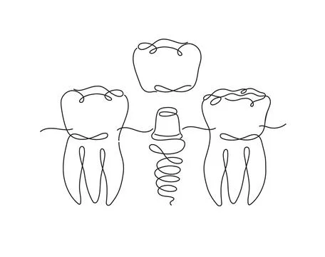 Teeth implant flat line white color 스톡 일러스트