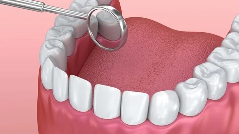 Teeth inspection with mirror. Medically accurate tooth 3D animation. Stock Footage 74246132