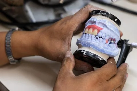 Teeth installed in the wax, analyzing the job Stock Photos