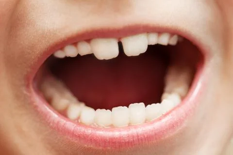 Teeth macro Stock Photos