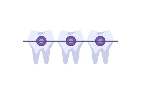 Teeth with metal braces flat style, vector illustration Stockillustratie