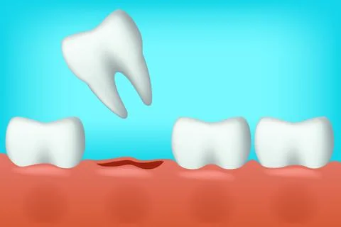 Teeth one fell Stock Illustration