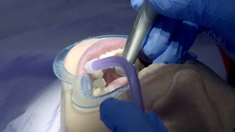 Teeth polishing at the dentist Stock Footage 149262479