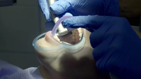 Teeth polishing at the dentist Stock Footage 149262503
