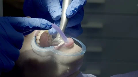 Teeth polishing at the dentist Stock Footage 149262509