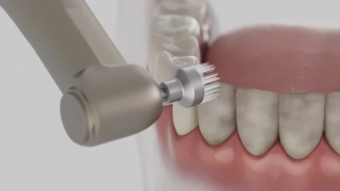 Teeth polishing Stock Footage 313949878