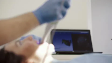 Teeth scanning in the dental office Video stock 147226304