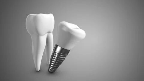 Teeth screw medical technology background 스톡 일러스트