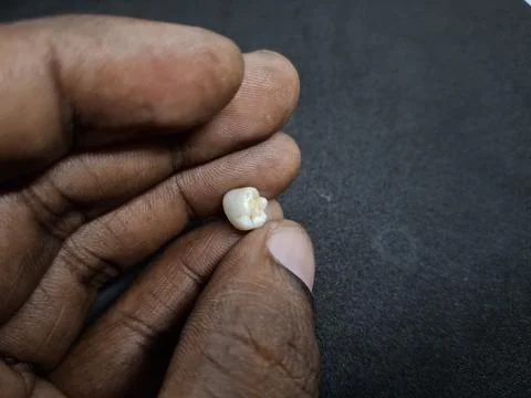 Teeth : Small, detached baby teeth Stock Photos
