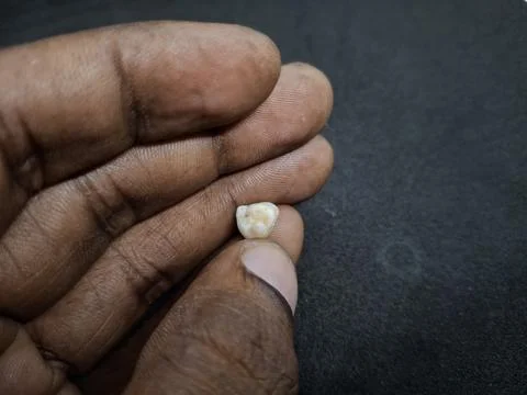 Teeth : Small, detached baby teeth Stock Photos