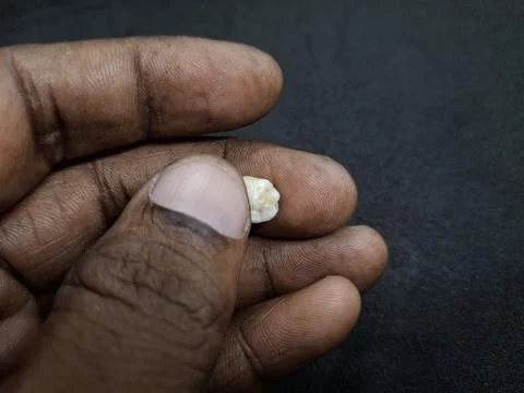 Teeth : Small, detached baby teeth Stock Photos