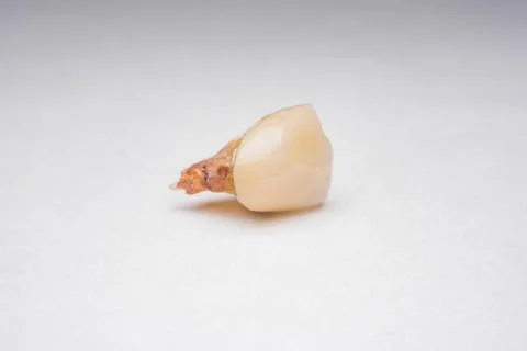 Teeth, tooth, Caries, decayed tooth Stock Photos