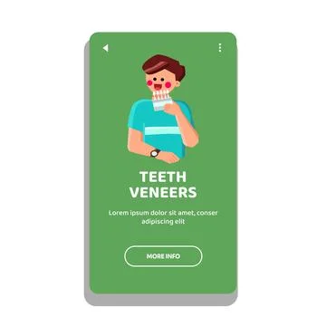 Teeth veneers vector Stock Illustration