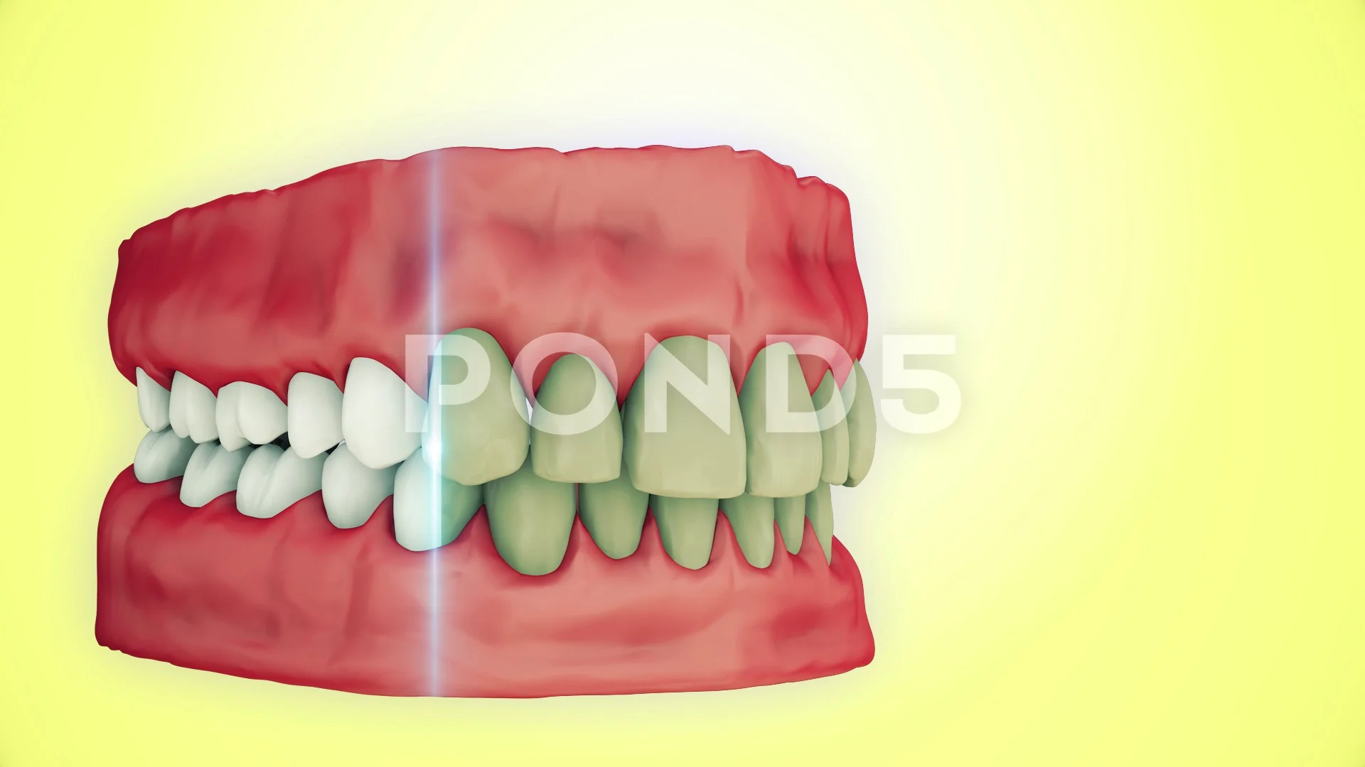 Teeth whitening 3D animation | Stock Video | Pond5