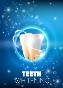 Teeth whitening ad vector realistic illustration Stock Illustration
