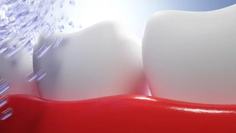 Teeth whitening and cleaning Stock Footage 278613476