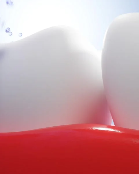 Teeth whitening and cleaning Stock Footage 278613515