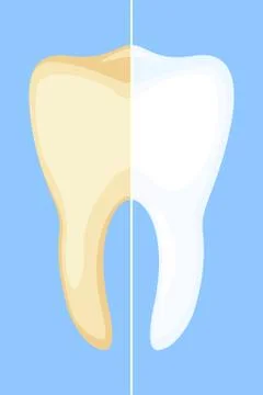 Teeth whitening concept. Stock Illustration