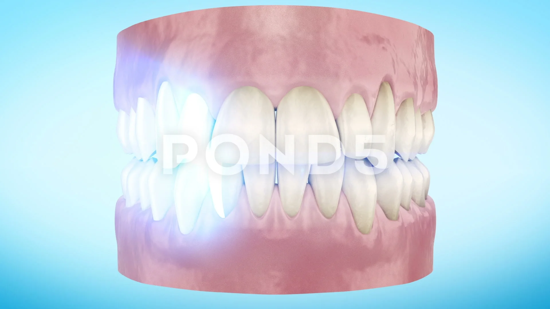 Teeth Whitening Procedure Close Up 3d An... | Stock Video | Pond5