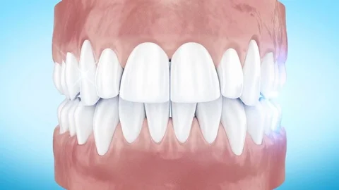 Teeth Whitening Procedure Close Up 3d An... | Stock Video | Pond5