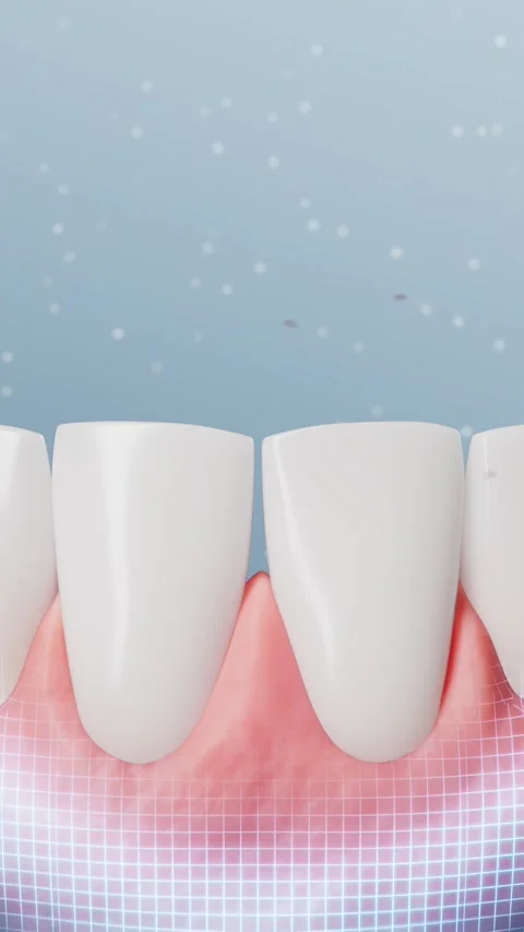 Teeth whitening, teeth cleaning, teeth protection Video stock 337876501