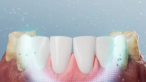 Teeth whitening, teeth cleaning, teeth protection Stock Footage 337876530