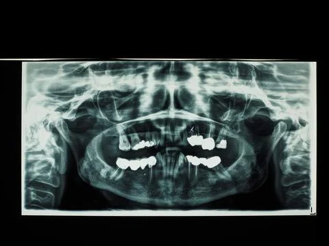 Teeth xray imagery Fotos Stock