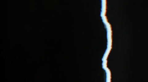 Television interference and twinkling, noise Stock Footage 60060993