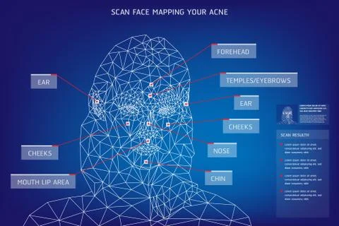 The Template Scan Face Mapping Your Acne Stock Illustration