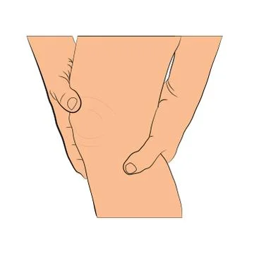 Tendon knee joint problems on leg from exercise vector illustration Illustrazione stock