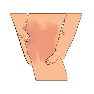 Tendon knee joint problems on leg from exercise vector illustration Illustrazione stock